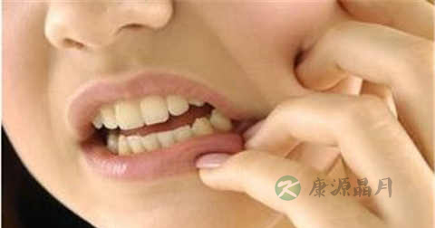 腮腺炎用什么药好的快