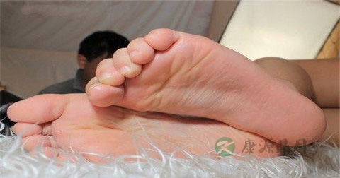 扁平足治疗方法