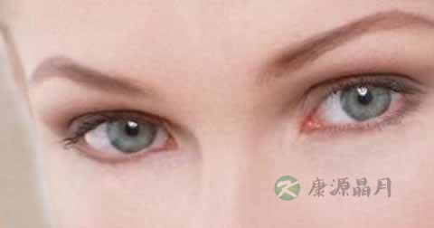 麦粒肿引起的红血丝怎么治