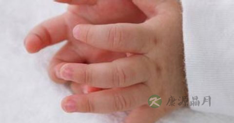 手足口病如何预防措施