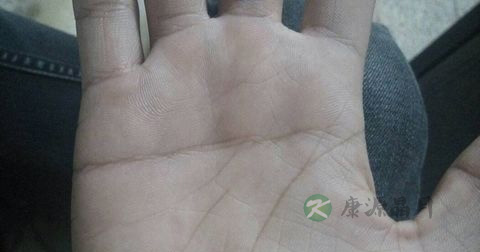大三阳会传染吗