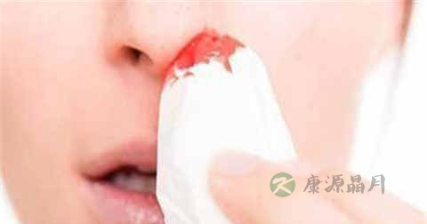 怎么治流鼻血