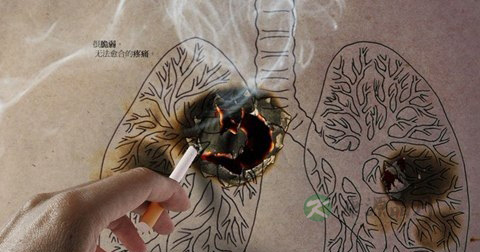 肺癌是传染病吗