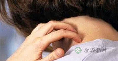 神经性皮炎能根治