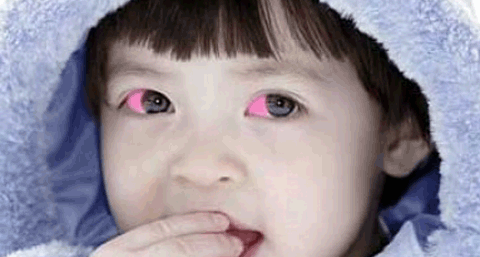 红眼病的传播途径