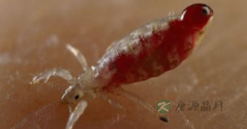 阴虱病有潜伏期吗