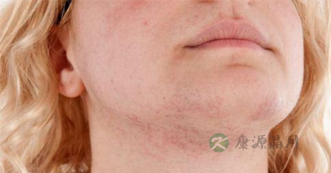 咽炎与声带小结的区别