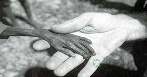水俣病是传染病吗