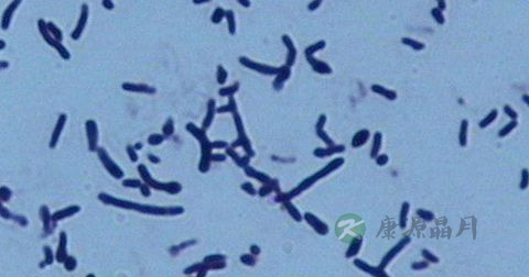 放线菌病是什么