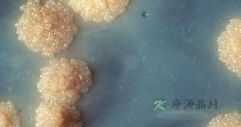 二期梅毒的临床表现