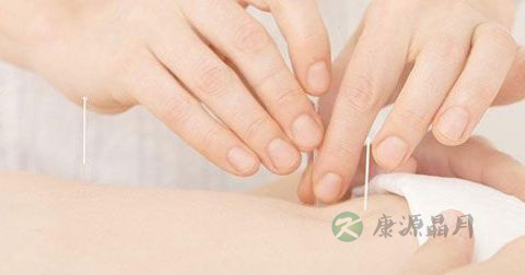 放血治疗法副作用