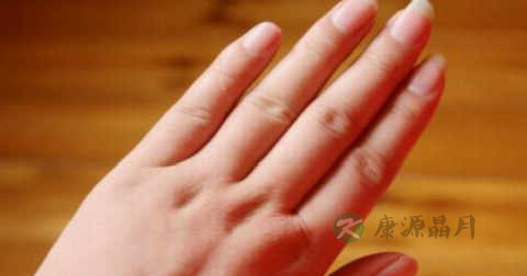 水肿病怎么治
