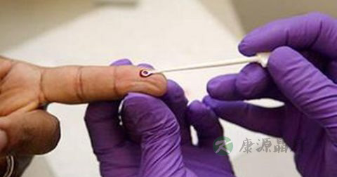 艾滋病检测方法