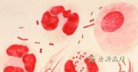 淋病的家庭治疗的方法