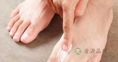 瘊子怎么去除