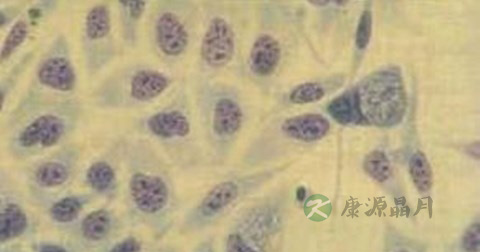 衣原体感染的原因