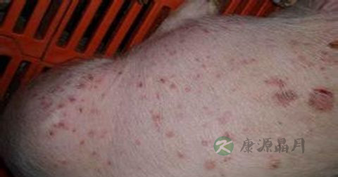 传染性红斑的治疗