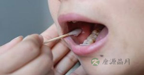 口腔上颚癌早期症状