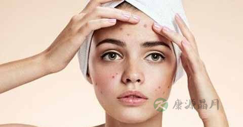 成人脓疱疮有什么治疗方法