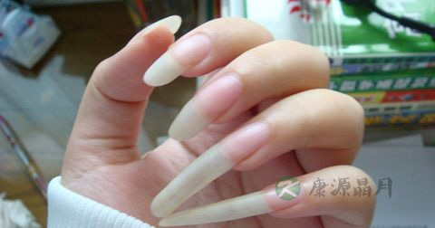 自己怎么治疗灰指甲