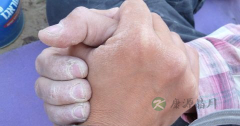 手足口病是怎么引起的