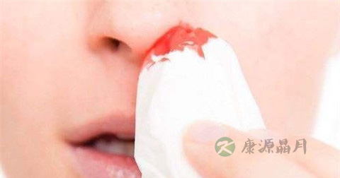 鼻子流血用什么药