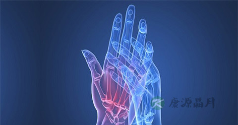 怎样预防关节炎