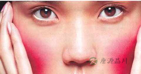 高原红怎么治