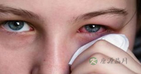 红眼病如何预防复发