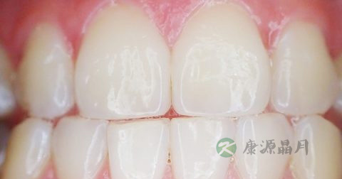 口中有hsv病毒吗