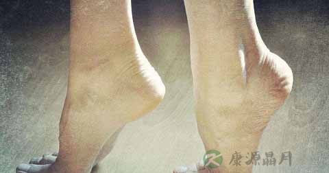 恋足癖怎么治