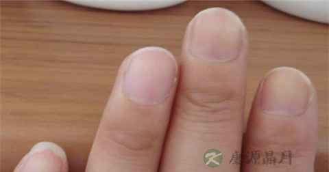 甲沟炎能治好吗