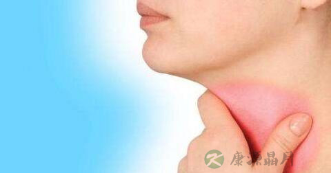 过敏性咽喉炎如何治疗