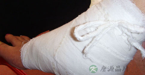 骨折了要如何进行急救