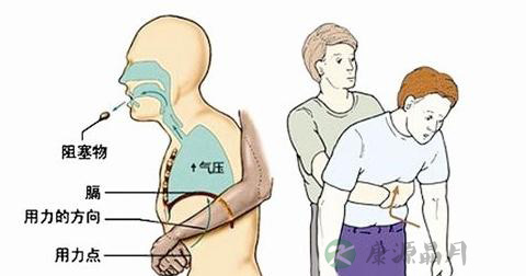 吃东西噎住了怎么办