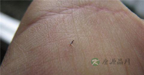 家庭急救常识大全