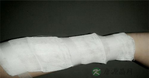胳膊摔断了怎么急救