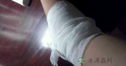 手部炸伤怎么办