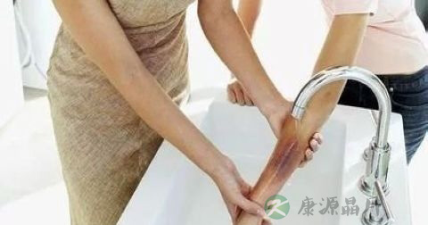 孕妇烫伤后怎么处理