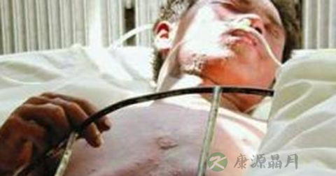如何处理腐蚀剂中毒