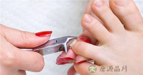 嵌甲怎么处理
