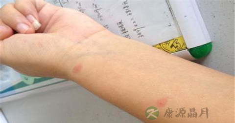 胳膊摔断了怎么急救