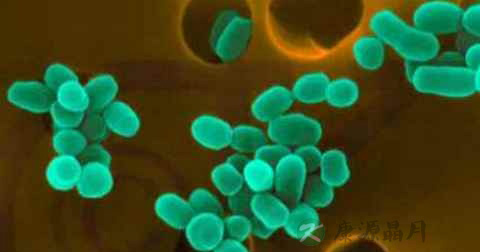 布鲁菌病传播途径