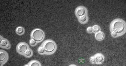隐球菌病由什么传播