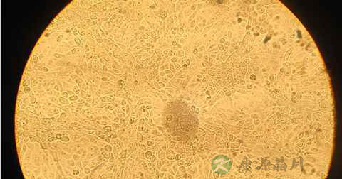 酵母菌的生殖方式与细菌有什么不同 