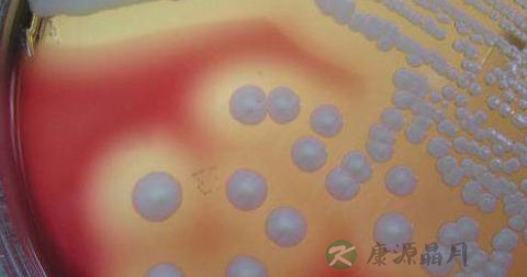 溶血葡萄球菌传播途径