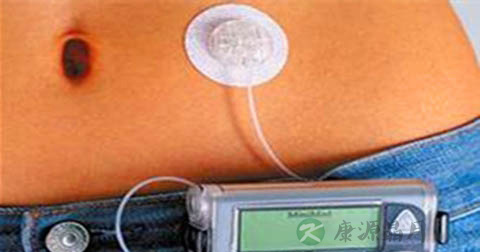 血糖试纸属于几类医疗器械