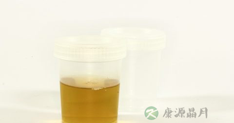 尿微量白蛋白检测试条使用方法