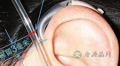 耳背式助听器如何使用