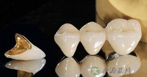 烤瓷牙有什么危害